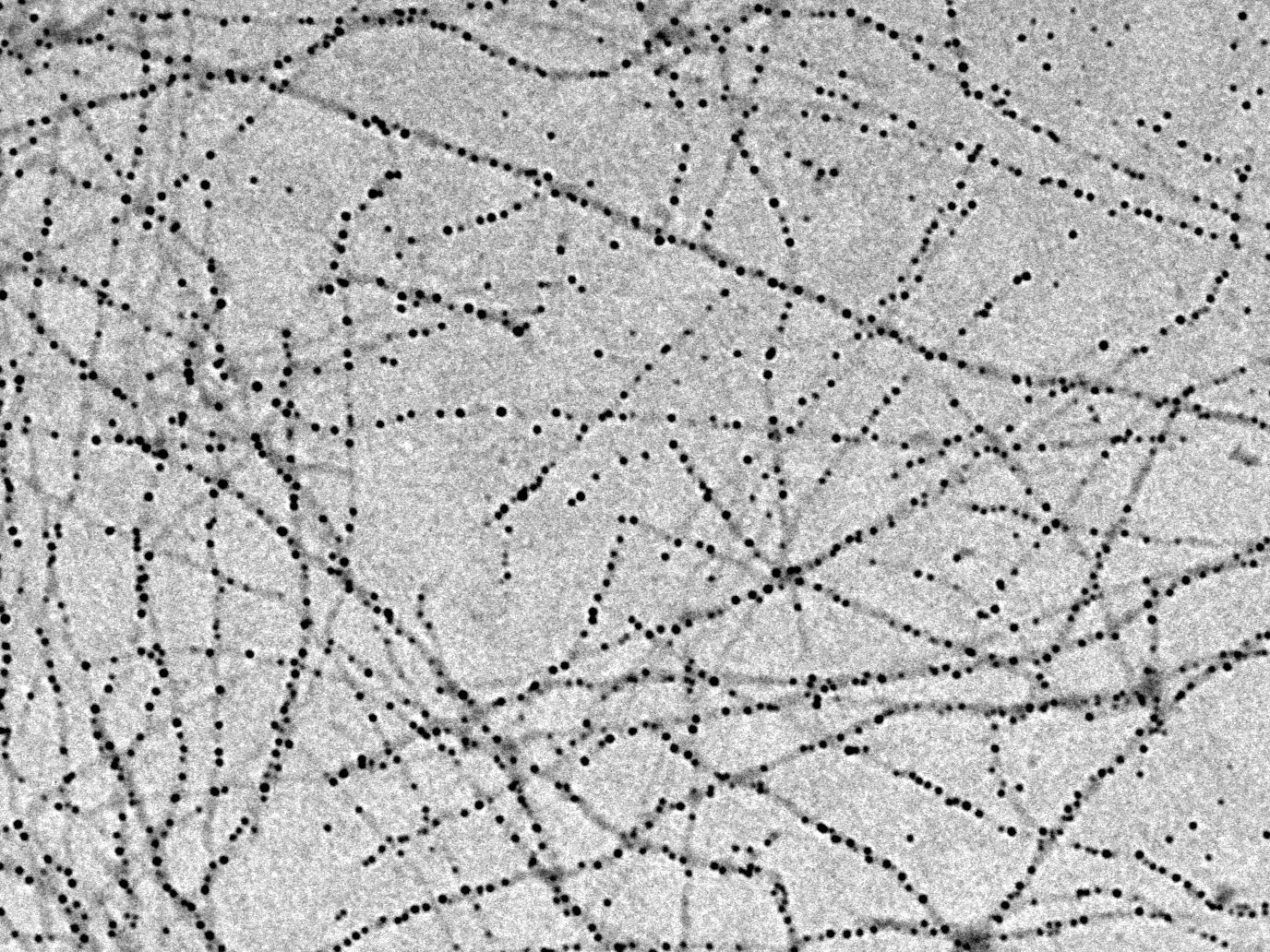 Bild von Nanofasern aus Milchprotein, auf denen sich Eisen-Nanopartikel angesammelt haben, aufgenommen mit einem Transmissionsel